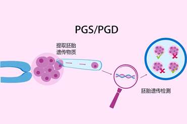 遗传筛查及诊断技术临床应用（PGS/PGD）