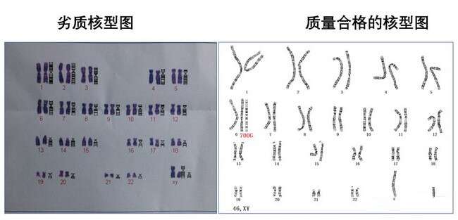 遗传筛查及诊断技术临床应用（PGS/PGD）