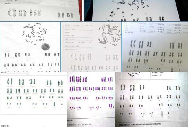 遗传筛查及诊断技术临床应用（PGS/PGD）