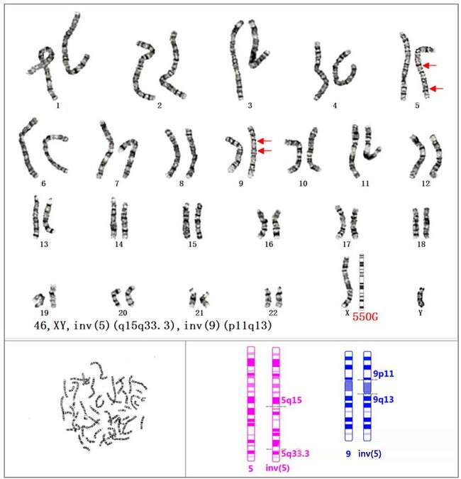 遗传筛查及诊断技术临床应用（PGS/PGD）