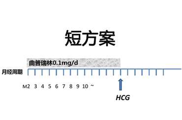 短方案是什么
