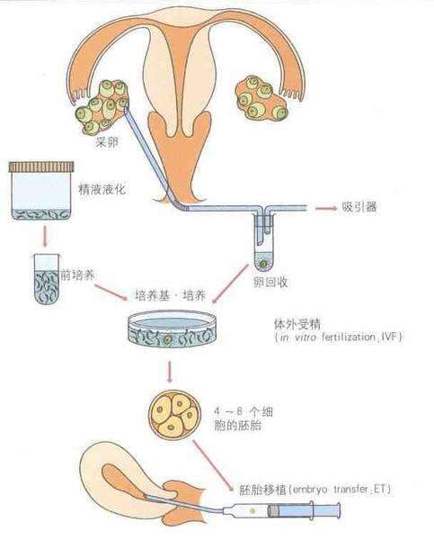 短方案是什么