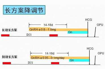试管婴儿长方案是什么