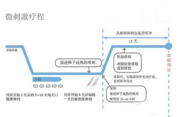 微刺激方案是什么