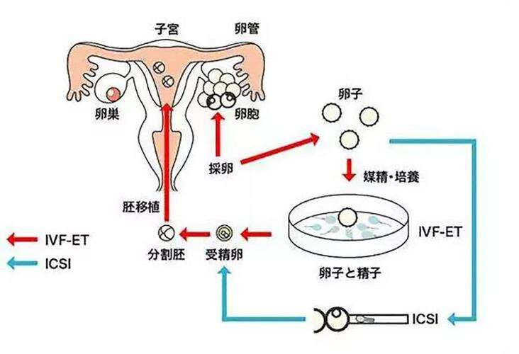 超长方案是什么