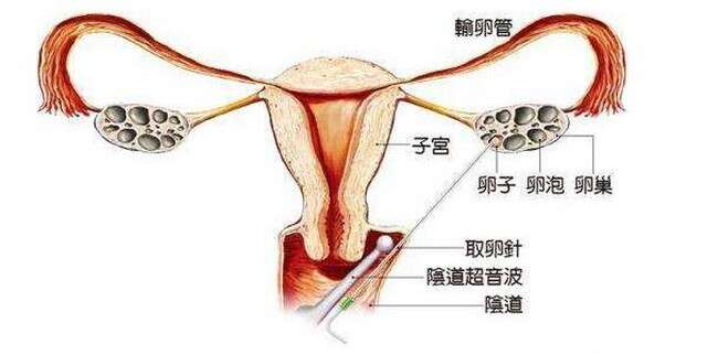 什么是促卵泡激素（FSH）