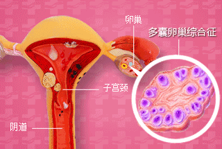 什么是促黄体生成素（LH）