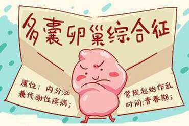 多囊卵巢综合症/多囊卵巢综合征