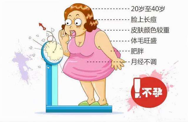 多囊卵巢综合症/多囊卵巢综合征