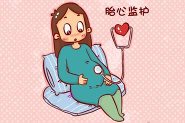 胎心监护