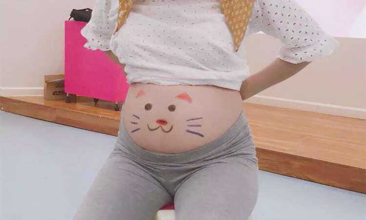 胎心监护