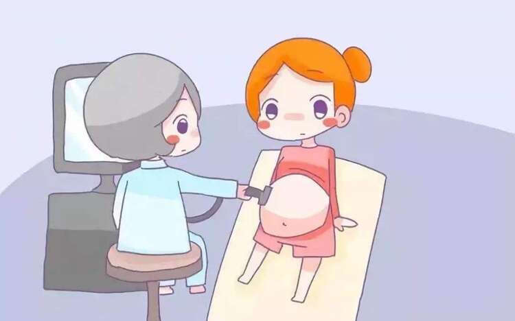 胎心监护