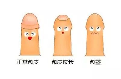 龟头炎
