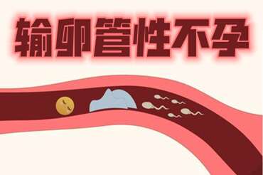 输卵管性不孕
