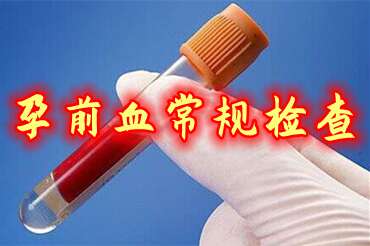 孕前血常规检查