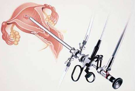 宫腔镜检查