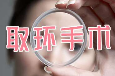 取环手术