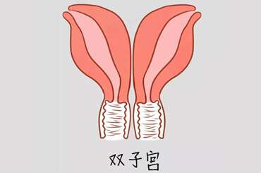 双子宫