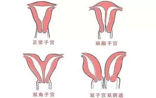 双子宫