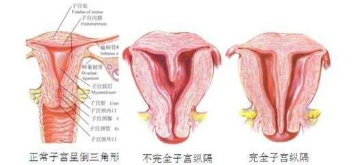 双子宫