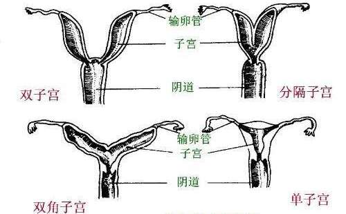 双子宫