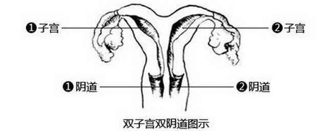 双子宫