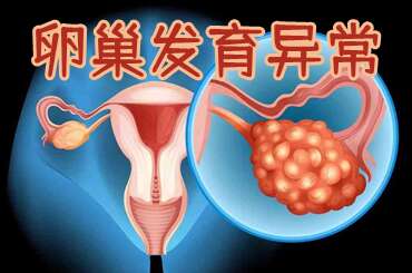 卵巢发育异常
