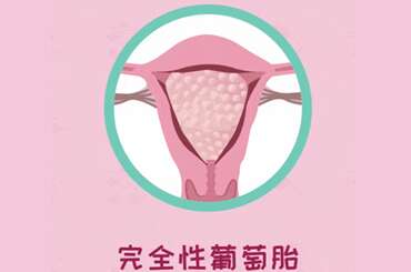 葡萄胎