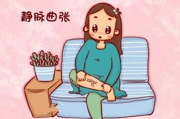 静脉曲张