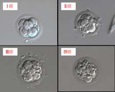 怎么分辨胚胎质量