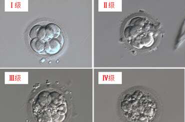 胚胎级别的划分