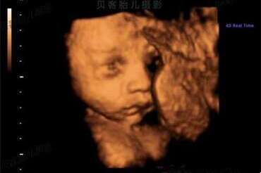 男性如何提升精子质量