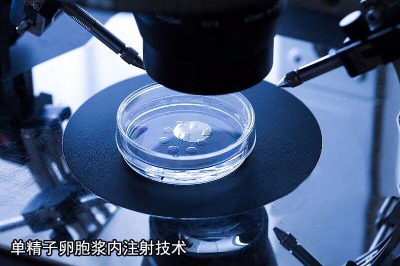 单精子卵胞浆内注射技术