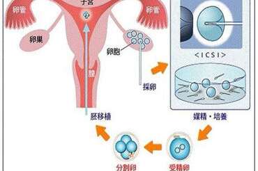 下腹痛的主因有哪些