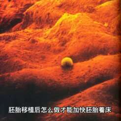 胚胎移植后怎么做才能加快胚胎着床？