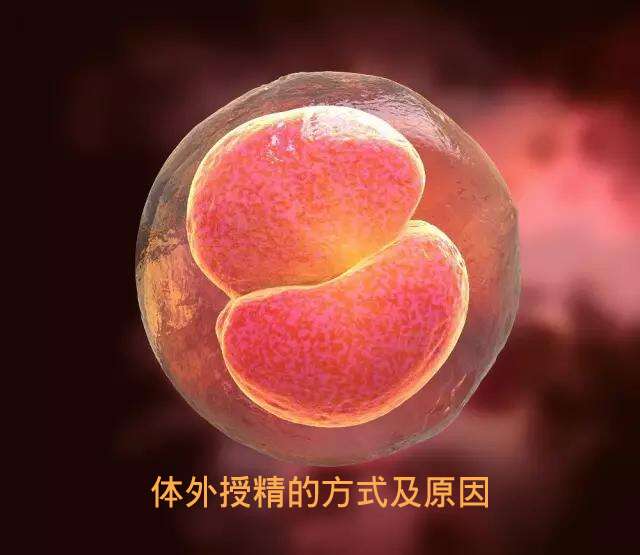 体外授精的方式及受精失败的原因