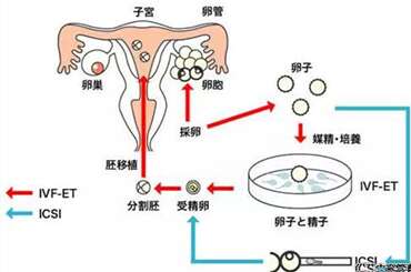人工授精的真正含义和用处