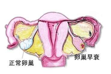 促排卵并不会影响卵巢中卵子的储备