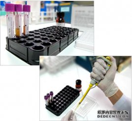 科普试管婴儿促排方案之促排短方案