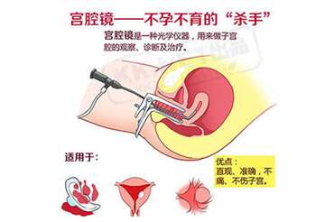 月经周期正常，但量变少要警惕宫腔粘连